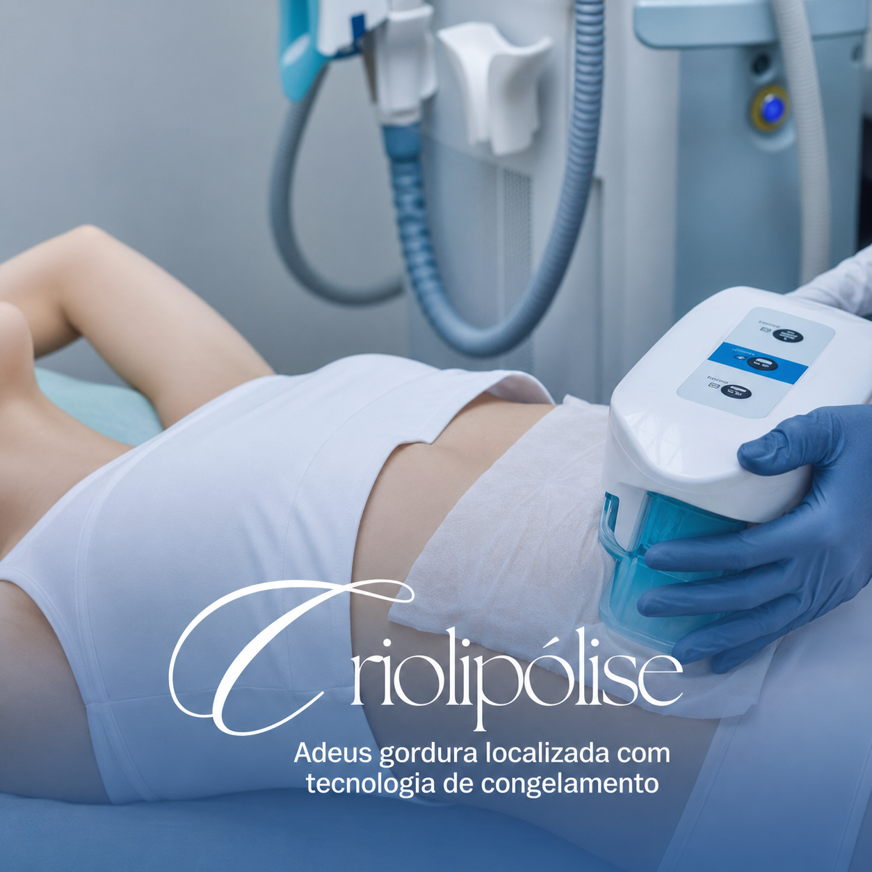 Criolipólise — adeus gordura localizada com tecnologia de congelamento